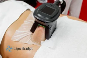 Are The Results From Aqualyx Permanent? 4 Compare Aqualyx Luton to other fat reduction treatments.