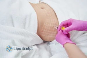 Are The Results From Aqualyx Permanent? 1 Do you want to know how long Aqualyx Luton results last?
