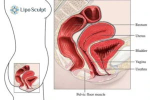 Treatment For A Leaky Bladder 2 How EM Chair treatment Luton can help Leaky bladder issues. Read more now!