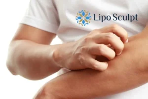 Best Actinic Keratoses Removal 4 prevent your actinic keratoses Luton getting worse - call our team today!